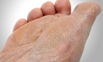 Camiños de transmisión de fungos no pé